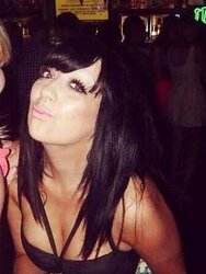 Phat congenital facebook mounds