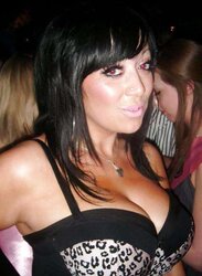 Phat congenital facebook mounds