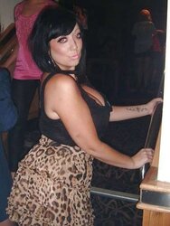 Phat congenital facebook mounds