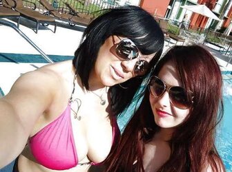 Phat congenital facebook mounds