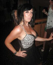 Phat congenital facebook mounds