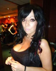 Phat congenital facebook mounds