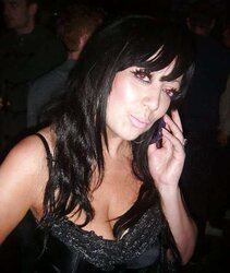 Phat congenital facebook mounds