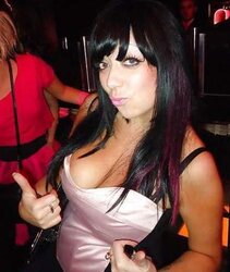 Phat congenital facebook mounds