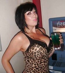 Phat congenital facebook mounds