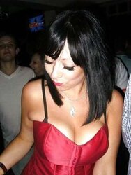 Phat congenital facebook mounds