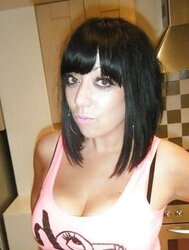 Phat congenital facebook mounds