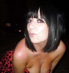 Phat congenital facebook mounds