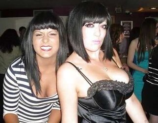 Phat congenital facebook mounds