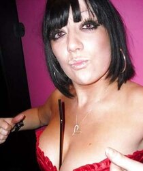 Phat congenital facebook mounds