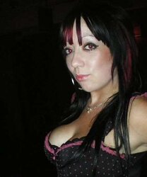 Phat congenital facebook mounds