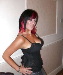 Phat congenital facebook mounds