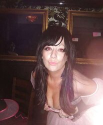 Phat congenital facebook mounds