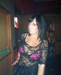 Phat congenital facebook mounds