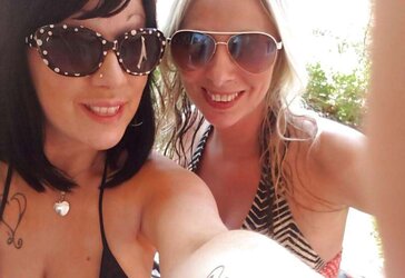 Phat congenital facebook mounds