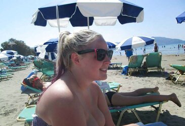 Phat congenital facebook mounds