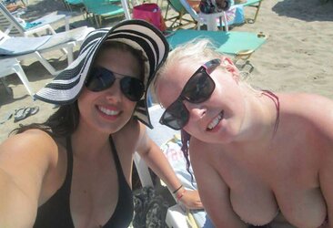 Phat congenital facebook mounds