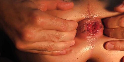 Gigantic assfist, big gape open up my bung 07.2011 part
