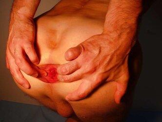 Gigantic assfist, big gape open up my bung 07.2011 part