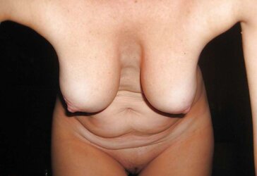 Hangers, Saggers and Nips