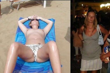 Before after 337.