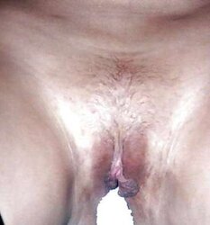 Areolas Knocker