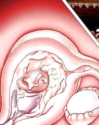 Deep inwards Hentai - Xray look