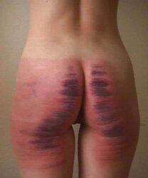 LASHING STRIPES