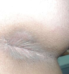 Amandas pink hole march