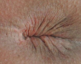 Amandas pink hole march
