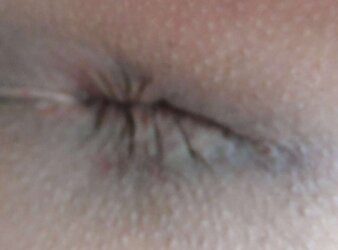 Amandas pink hole march