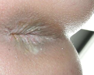 Amandas pink hole march