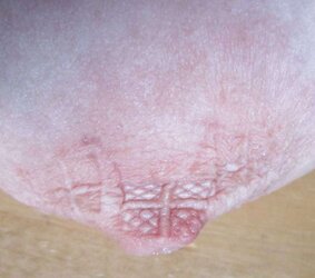 Zitzenbehandlung des Schweins