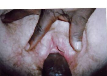 My beloved vulvas