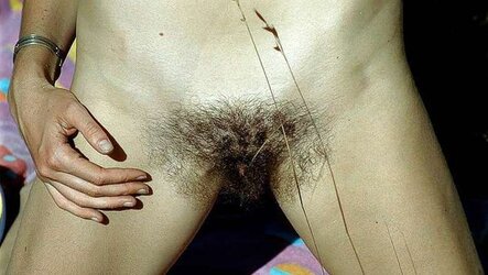 Wooly, for those that enjoy them congenital
