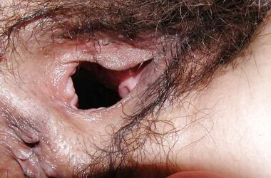Widely Opened crevices