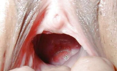 Widely Opened crevices