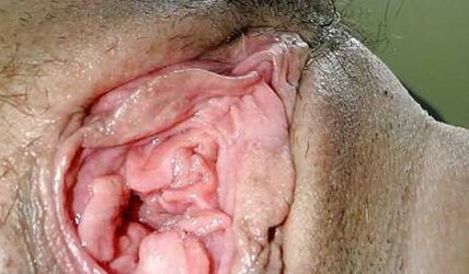 Widely Opened crevices