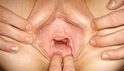 Widely Opened crevices