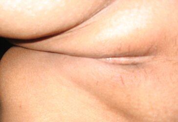 Pattaya vulvas i ravage