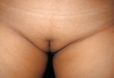 Pattaya vulvas i ravage