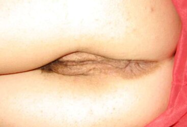 Fur Covered vag unsheathed