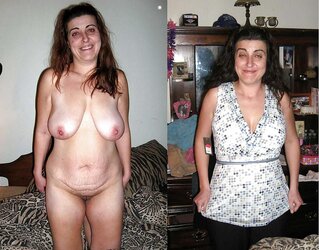 Before after 313 (saggy hooters sensational)