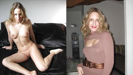 Before After 176.