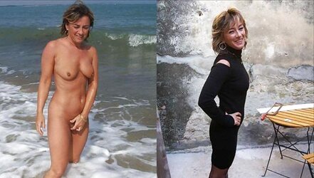 Before After 176.