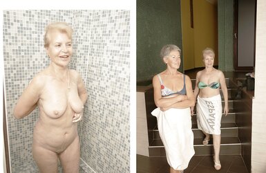 Before after 357.