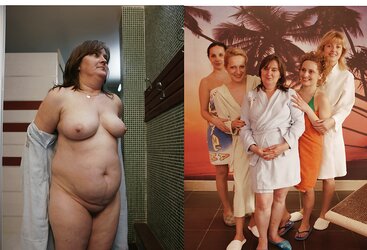 Before after 357.