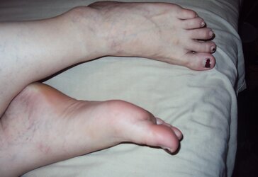 A few more photos of my soles