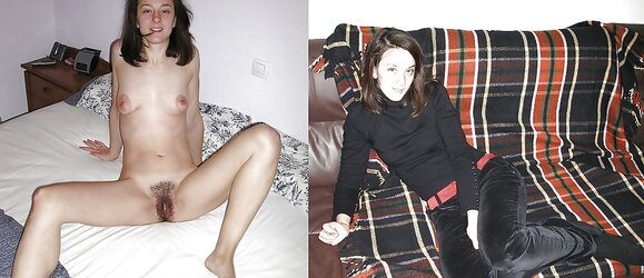 Before after 491.