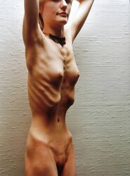 Anorexic photos